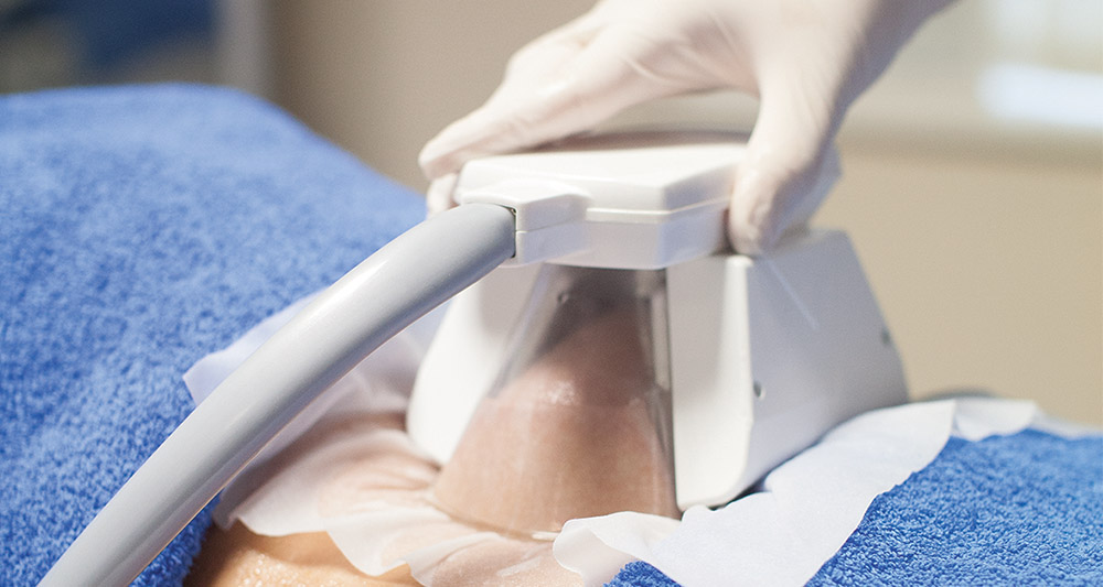 How Fat Freezing and HIFU Work Together? 2 Multiple Areas in One Session HIFU and Fat Freezing Northampton