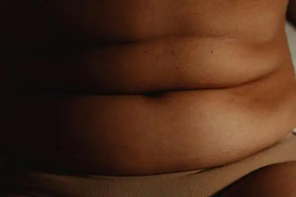 The Hidden Connection: How Stress Shapes Your Fitness and Body Composition 3 image of what stress can do on the stomach area and how Lipo 360 Northampton can help to change your body shape.